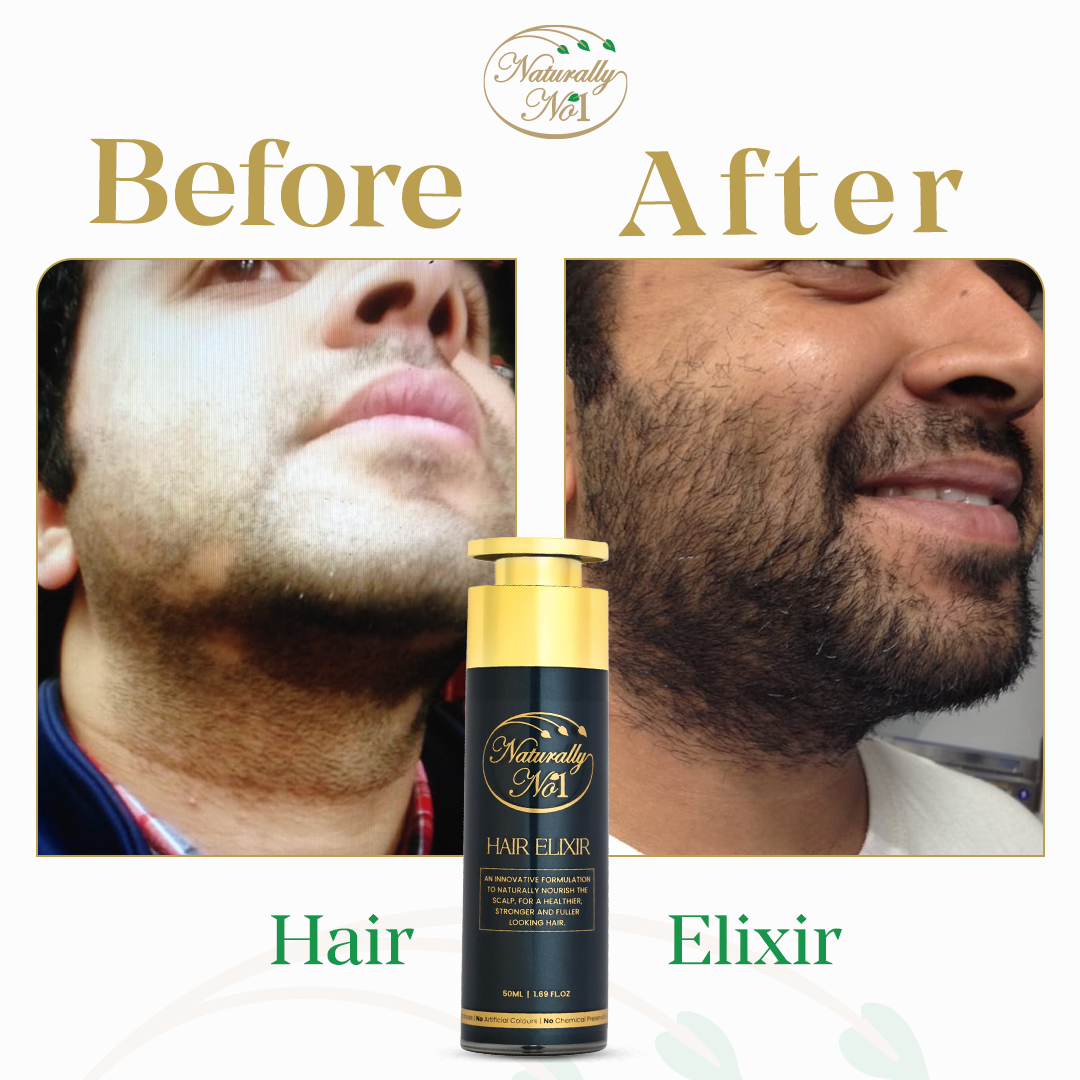 إكسير للشعر | 50 مل - Before & After 1