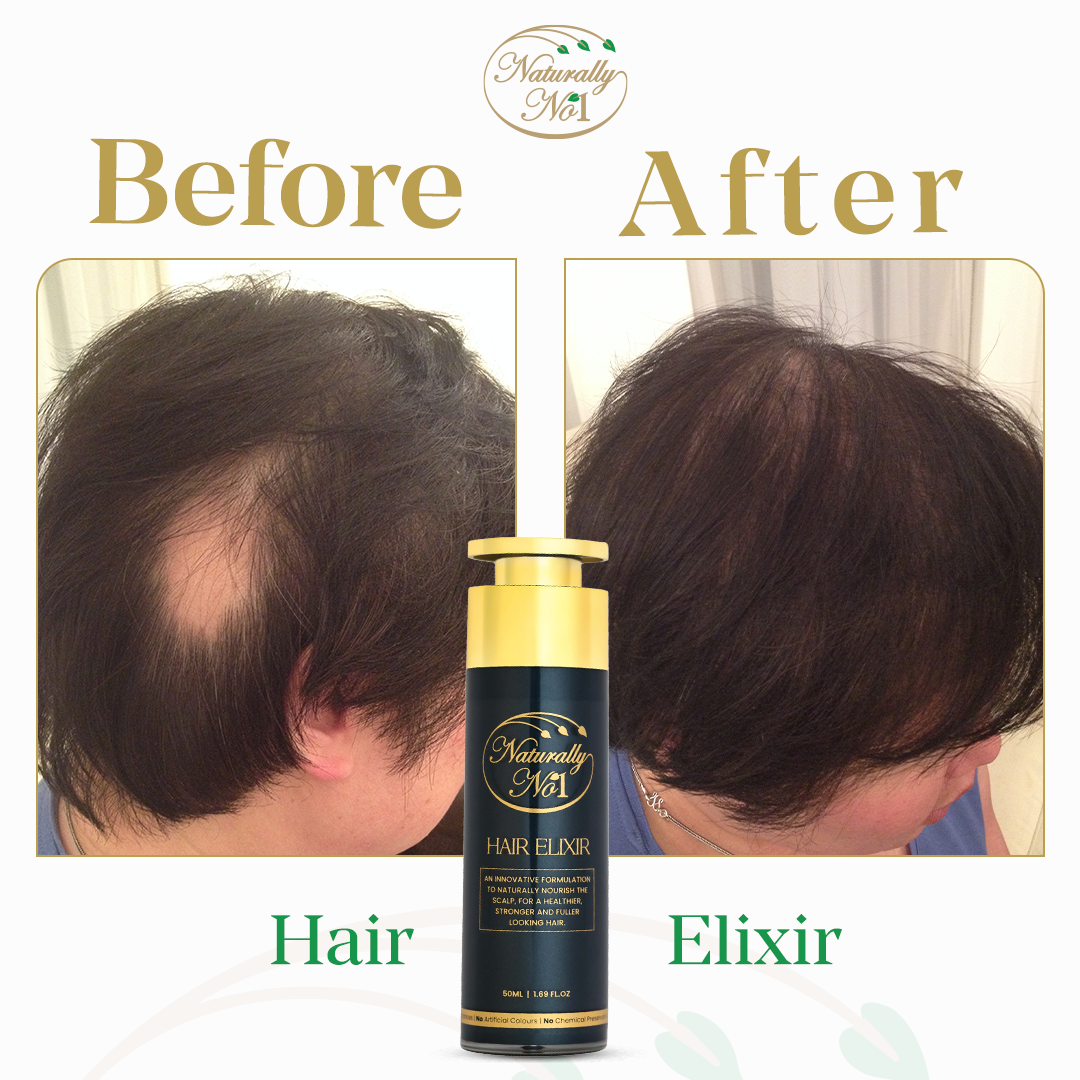 إكسير للشعر | 50 مل - Before & After 2