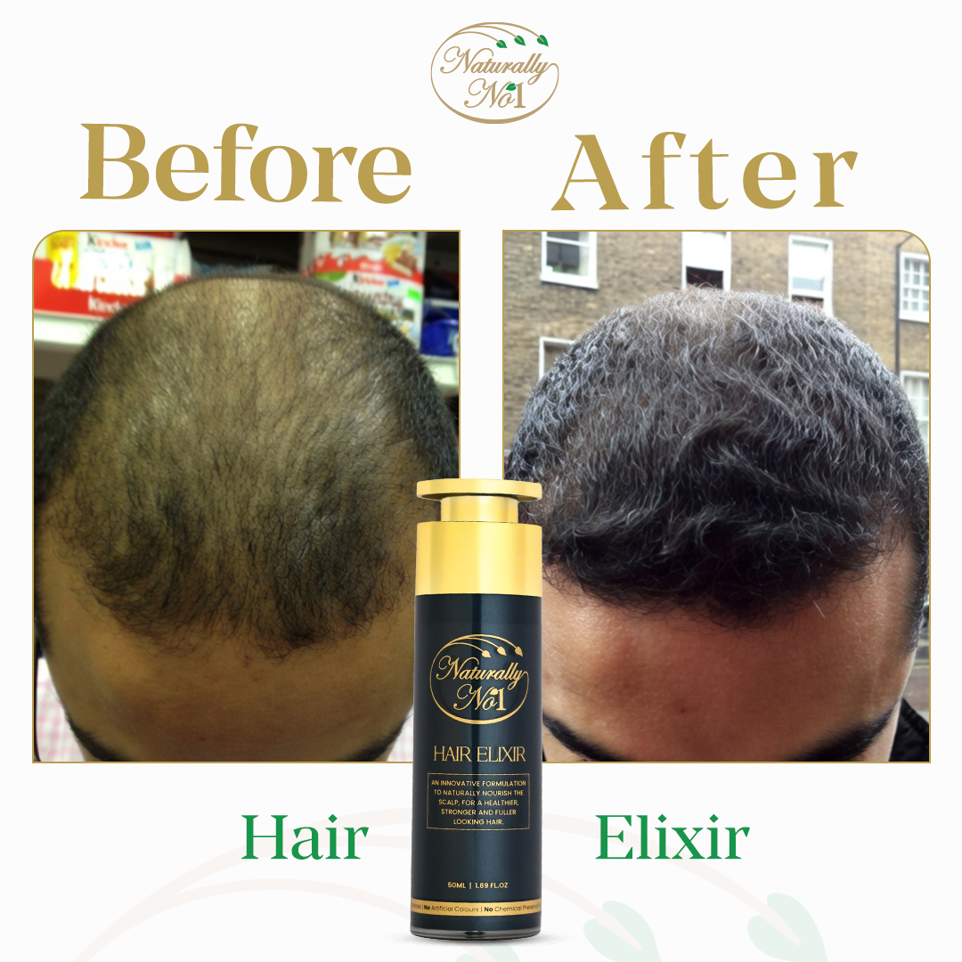 إكسير للشعر | 50 مل - Before & After 3