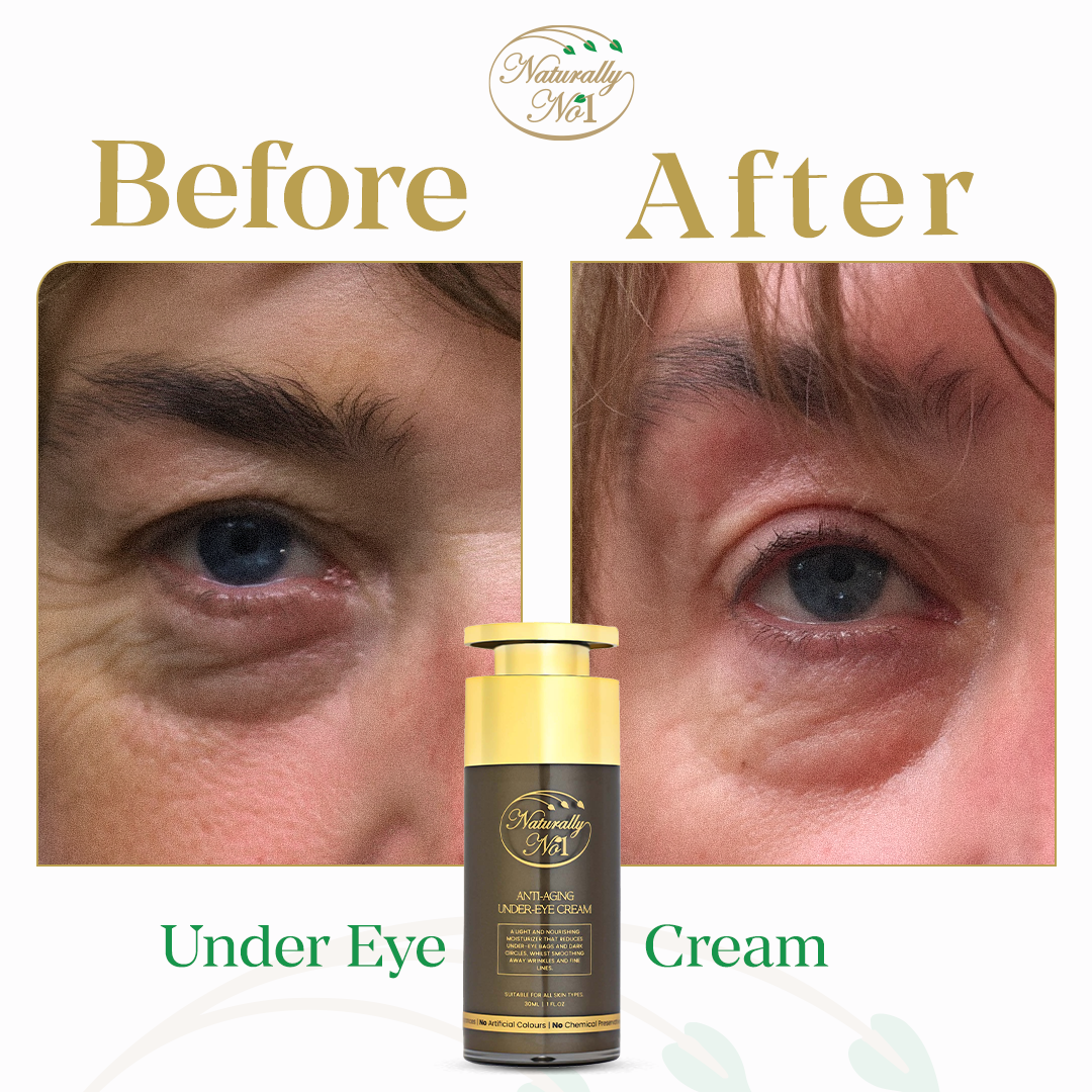 Anti-Aging Under Eye Cream | 30ml - Before & After 1