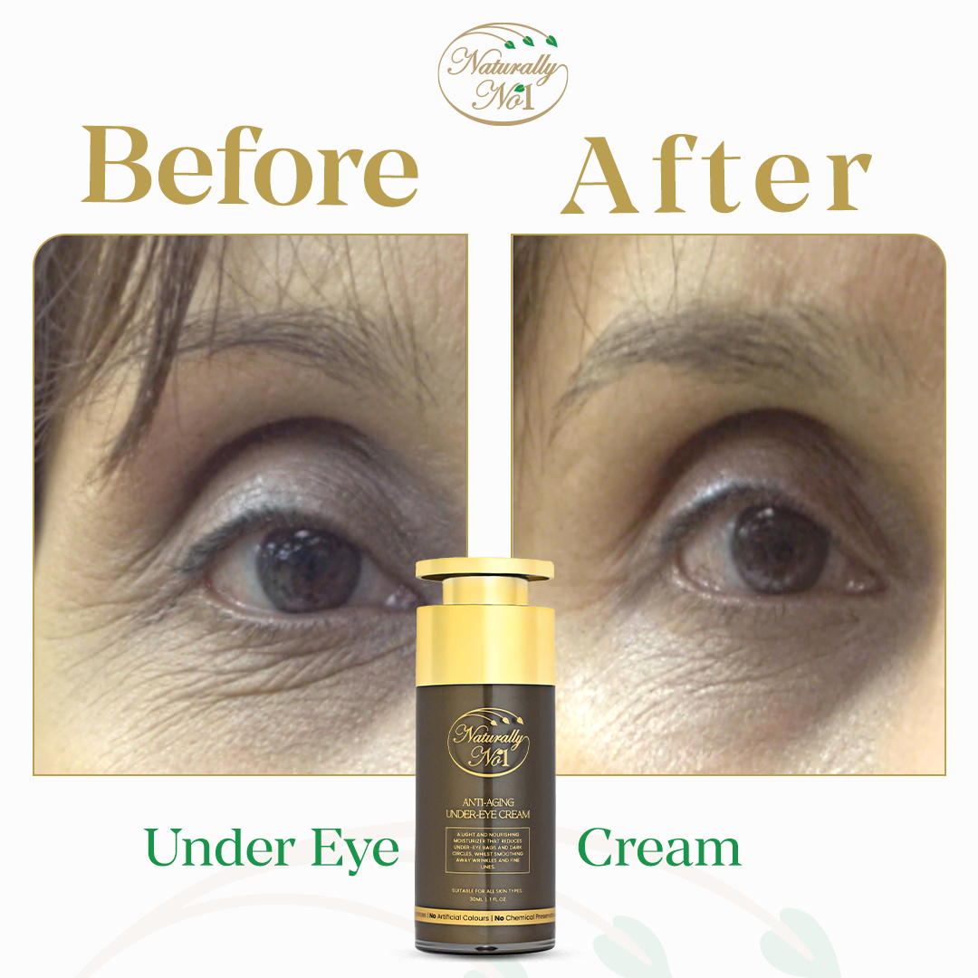 Anti-Aging Under Eye Cream | 30ml - Before & After 2