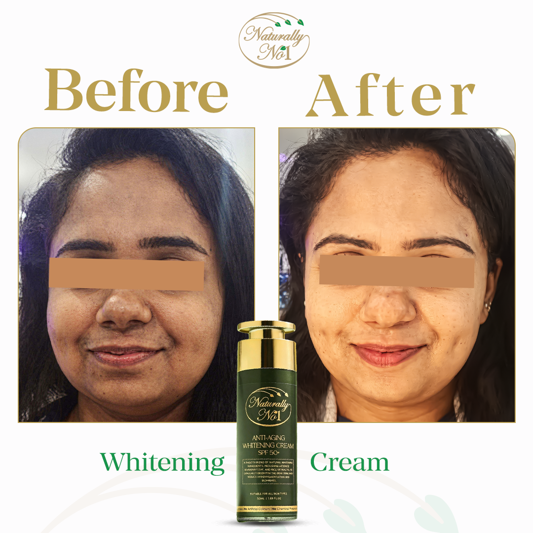 كريم تبييض | 50 مل - Before & After 1